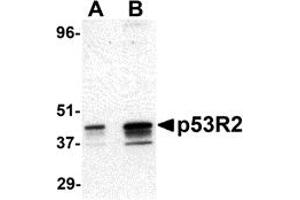 Western Blotting (WB) image for anti-Ribonucleotide Reductase M2 B (TP53 Inducible) (RRM2B) (N-Term) antibody (ABIN1031501) (RRM2B 抗体  (N-Term))