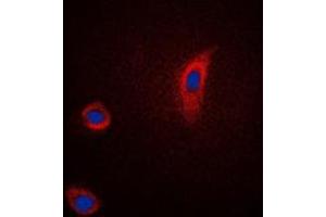 Immunofluorescent analysis of PGHS-2 staining in Jurkat cells. (PTGS2 抗体  (C-Term))