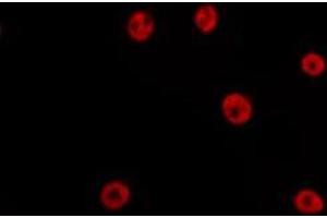 ABIN6275198 staining HepG2 by IF/ICC. (Six5 抗体  (C-Term))