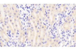 Immunohistochemistry (IHC) image for anti-Succinate Dehydrogenase Complex, Subunit A, Flavoprotein (Fp) (SDHA) (AA 4-300) antibody (ABIN7441595)