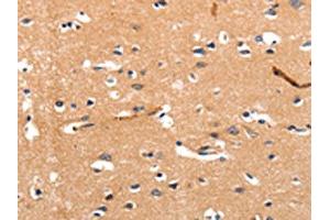The image on the left is immunohistochemistry of paraffin-embedded Human brain tissue using ABIN7190258(CHRNA3 Antibody) at dilution 1/30, on the right is treated with synthetic peptide. (CHRNA3 抗体)