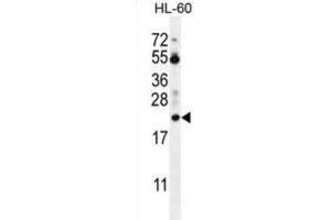 Western Blotting (WB) image for anti-Prothymosin, alpha (PTMA) antibody (ABIN2996364) (PTMA 抗体)