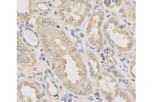 Immunohistochemistry of paraffin-embedded Human kidney using DCTN2 Polyclonal Antibody at dilution of 1:200 (40x lens). (Dynamitin 抗体)