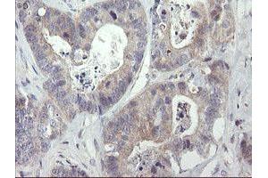 Image no. 6 for anti-Receptor (TNFRSF)-Interacting serine-threonine Kinase 1 (RIPK1) (AA 133-422) antibody (ABIN1490909)