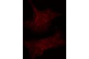 ABIN6275519 staining  Hela cells by IF/ICC. (DVL3 抗体)