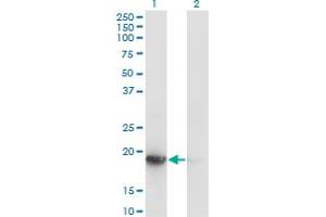Western Blot analysis of UBE2G1 expression in transfected 293T cell line by UBE2G1 monoclonal antibody (M01), clone 1C12-1B2. (UBE2G1 抗体  (AA 1-170))