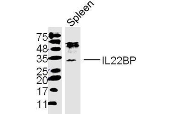 IL22RA2 Antikörper  (AA 165-263)