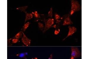 Immunofluorescence analysis of NIH-3T3 cells using CLUH Polyclonal Antibody at dilution of 1:100 (40x lens). (CLUH 抗体)