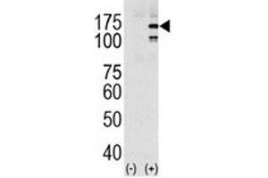 Western blot analysis of EGFR in HeLa cell lysate, either noninduced (Lane 1) or induced with EGF (2). (EGFR 抗体  (pTyr1069))