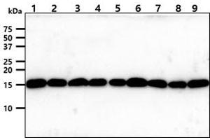 The cell lysates (40ug) were resolved by SDS-PAGE, transferred to PVDF membrane and probed with anti-human Tomm20 antibody (1:1000). (TOMM20 抗体)