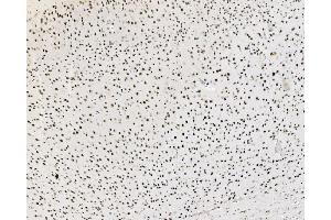 IHC analysis of JUNB using anti-JUNB antibody (ABIN7603223). (JunB 抗体  (N-Term))