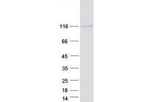 Western Blotting (WB) image for Ubiquitin Specific Peptidase 15 (USP15) protein (Myc-DYKDDDDK Tag) (ABIN2735096)