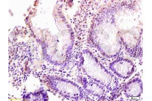 Formalin-fixed and paraffin: rat intestine tissue labeled with Anti-LZTFL1 Polyclonal Antibody , Unconjugated at at 1:200 followed by conjugation to the secondary antibody and DAB staining (LZTFL1 抗体  (AA 101-200))