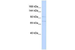 Western Blotting (WB) image for anti-Solute Carrier Family 8 (Sodium/calcium Exchanger), Member 3 (SLC8A3) (N-Term) antibody (ABIN2781702)