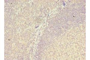 Immunohistochemistry of paraffin-embedded human tonsil tissue using ABIN7175970 at dilution of 1:100 (ZNF238 抗体  (AA 62-364))