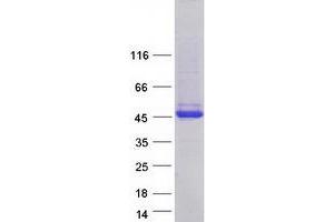 Western Blotting (WB) image for Melanoma Antigen Family A, 4 (MAGEA4) (Transcript Variant 3) protein (Myc-DYKDDDDK Tag) (ABIN2725176)