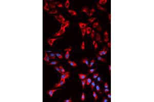 Immunofluorescence analysis of U2OS cells using EIF4B antibody. (EIF4B 抗体  (AA 352-611))
