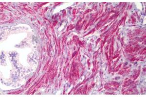 Anti-PMEPA1 antibody IHC staining of human prostate, smooth muscle. (PMEPA1 抗体  (AA 101-150))