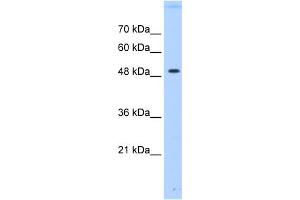 WB Suggested Anti-PTPN1 Antibody Titration:  0. (PTPN1 抗体  (Middle Region))