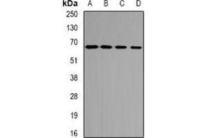 Western blot analysis of ETFDH expression in mouse heart (A), mouse kidney (B), rat liver (C), rat heart (D) whole cell lysates. (ETFDH 抗体)