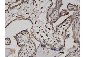 Immunostaining (ISt) image for anti-ATPase, H+ Transporting, Lysosomal 70kDa, V1 Subunit A (ATP6V1A) (AA 508-617) antibody (ABIN513626)