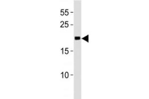 Western Blotting (WB) image for anti-O6-Methylguanine-DNA-Methyltransferase (MGMT) (AA 156-182) antibody (ABIN3032088)