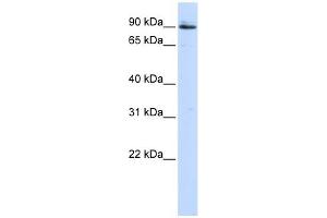 PCSK5 antibody used at 1 ug/ml to detect target protein. (PCSK5 抗体  (Middle Region))