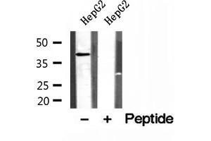 Western blot analysis of extracts of HepG2 cells, using PSAT1 antibody. (PSAT1 抗体  (Internal Region))
