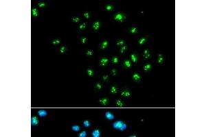 Immunofluorescence analysis of MCF-7 cells using EIF6 Polyclonal Antibody (EIF6 抗体)