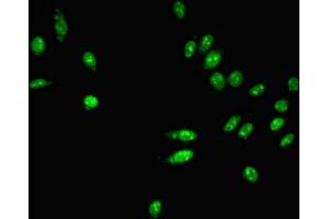 Immunofluorescent analysis of Hela cells using ABIN7163761 at dilution of 1:100 and Alexa Fluor 488-congugated AffiniPure Goat Anti-Rabbit IgG(H+L) (PARN 抗体  (AA 1-639))