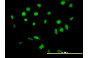 Immunofluorescence of  purified  MaxPab antibody to GPS1 on HeLa cell. (GPS1 抗体  (AA 1-527))