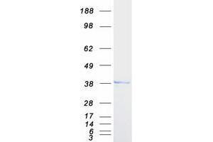 Western Blotting (WB) image for Torsin Family 1, Member A (Torsin A) (TOR1A) protein (Myc-DYKDDDDK Tag) (ABIN2734029)