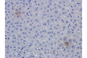 Immunohistochemical analysis of rat liver using anti-TNFalpha antibody   Formalin fixed rat liver slices were stained with a  at 5 µg/ml. (Recombinant TNF alpha (Humicade Biosimilar) 抗体)