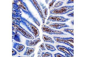 IHC analysis of CD31/Pecam1 using anti-CD31/Pecam1 antibody (ABIN7601662). (CD31 抗体  (AA 41-258))
