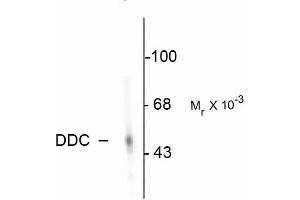 Western blots of rat adrenal medulla. (DDC 抗体)