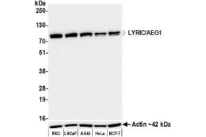 Western Blotting (WB) image for anti-Metadherin (MTDH) (AA 475-525) antibody (ABIN7795651) (Recombinant MTDH 抗体  (AA 475-525))