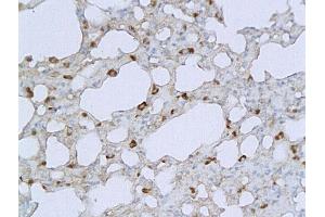 Formalin-fixed and paraffin embedded mouse lung labeled with Anti PRSS10/TMPRSS2 Polyclonal Antibody, Unconjugated (ABIN716876) followed by conjugation to the secondary antibody and DAB staining (TMPRSS2 抗体  (AA 301-400))