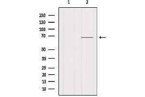 Western blot analysis of extracts from Mouse lung, using Ezrin Antibody. (Ezrin 抗体  (C-Term))