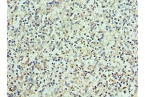 Immunohistochemistry of paraffin-embedded human spleen tissue using ABIN7145171 at dilution of 1:100 (BCL11A 抗体  (AA 1-230))