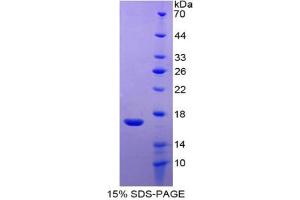 SDS-PAGE analysis of Dog RANTES Protein. (CCL5 蛋白)