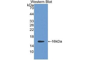 Western Blotting (WB) image for anti-HtrA Serine Peptidase 1 (HTRA1) (AA 10-146) antibody (ABIN1859231) (HTRA1 抗体  (AA 10-146))