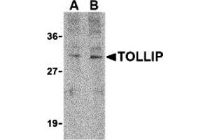 Western Blotting (WB) image for anti-Toll Interacting Protein (TOLLIP) (C-Term) antibody (ABIN1030762) (TOLLIP 抗体  (C-Term))