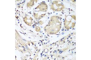 Immunohistochemistry of paraffin-embedded human stomach using NID1 antibody at dilution of 1:100 (40x lens). (Nidogen 1 抗体)