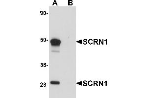 Western Blotting (WB) image for anti-Secernin 1 (SCRN1) (C-Term) antibody (ABIN1030648) (Secernin 1 抗体  (C-Term))