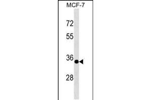 Western blot analysis in MCF-7 cell line lysates (35ug/lane). (EPSTI1 抗体  (N-Term))