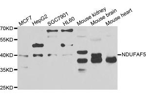 Western blot analysis of extracts of various cell lines, using NDUFAF5 antibody. (C20orf7 抗体)