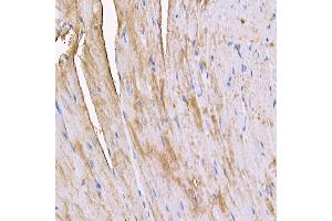 Immunohistochemistry of paraffin-embedded mouse heart using MYH4 antibody (ABIN7268749) at dilution of 1:150 (40x lens). (MYH4 抗体  (AA 1450-1550))