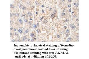 Image no. 1 for anti-Aldo-Keto Reductase Family 1, Member A1 (Aldehyde Reductase) (AKR1A1) antibody (ABIN791183) (AKR1A1 抗体)