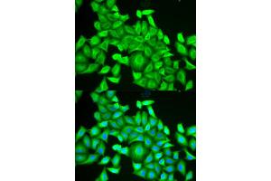 Immunofluorescence (IF) image for anti-RAB6A, Member RAS Oncogene Family (RAB6A) antibody (ABIN1876814) (RAB6A 抗体)