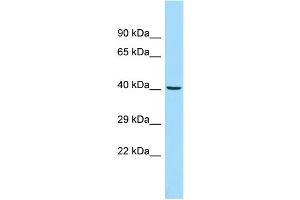 Host: Rabbit Target Name: ADRM1 Sample Type: MCF7 Whole Cell lysates Antibody Dilution: 1.